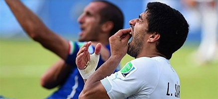FIFA Soccer - Dr. Keen offers Suarez a custom Sports Guard